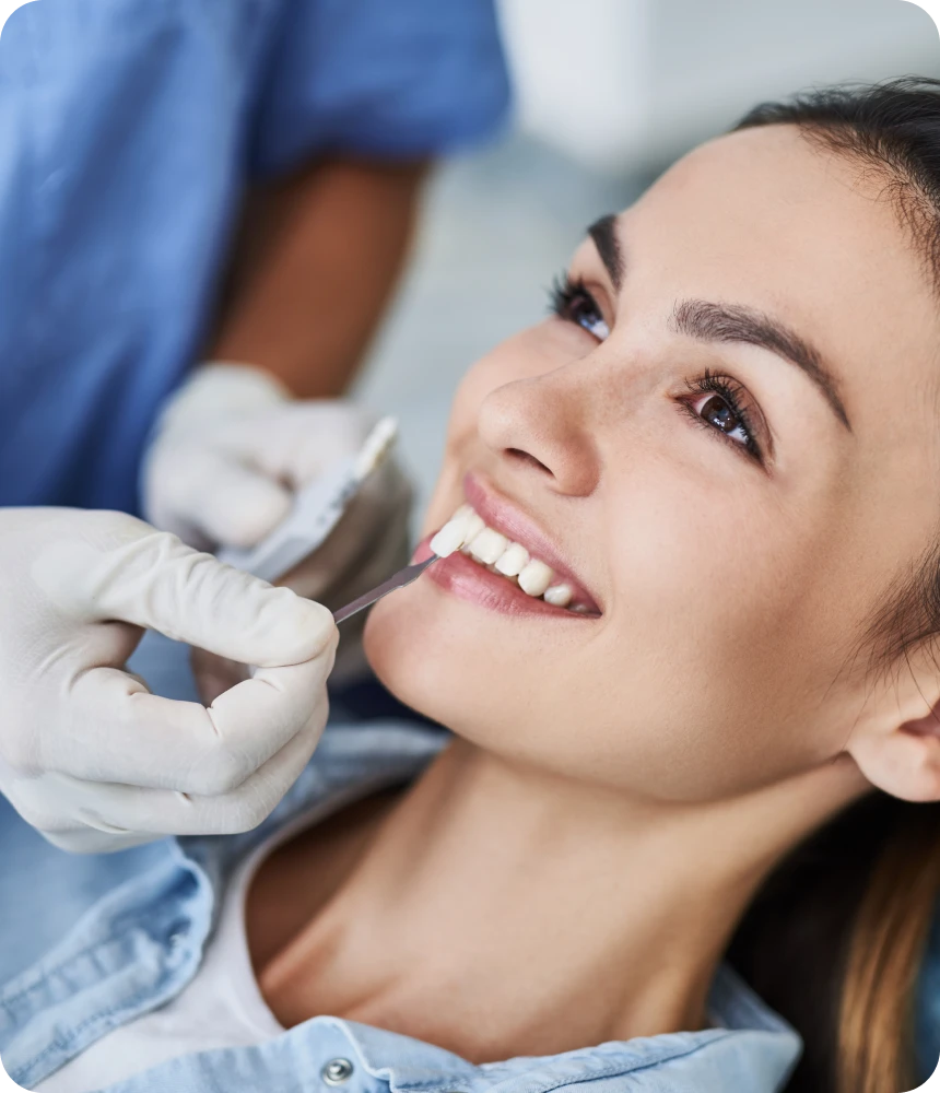 Facettes et esthétique