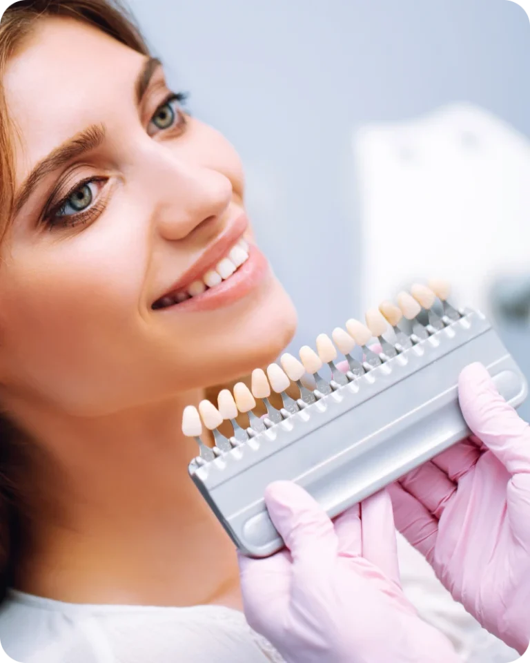 Facettes céramiques