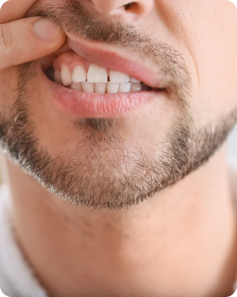 Traitement de la gingivite