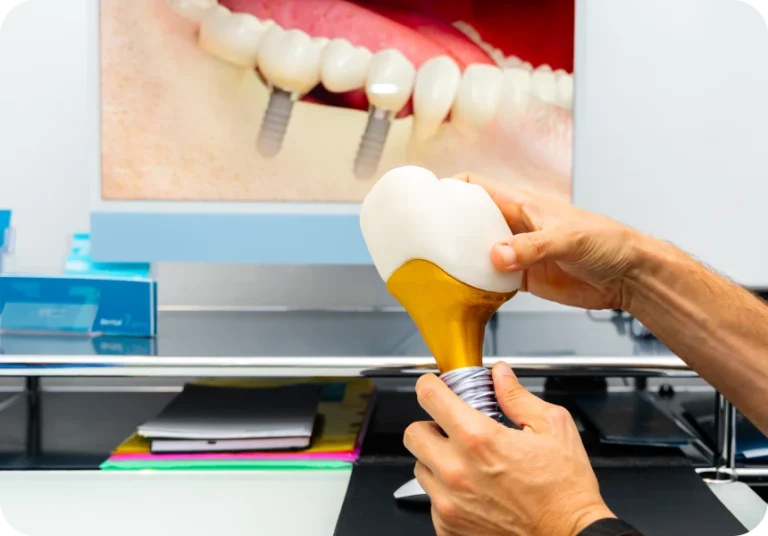 Parodontologie et implantologie