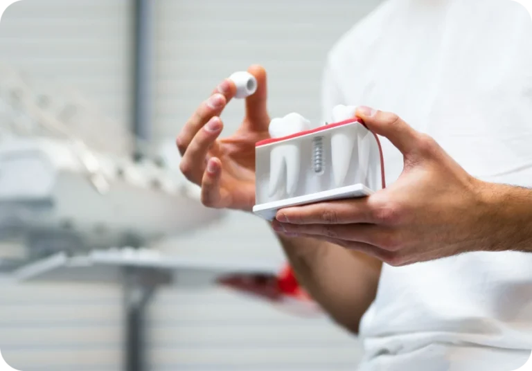 Implants et prothèses immédiates