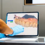technologie-dentaire-empreinte-optique