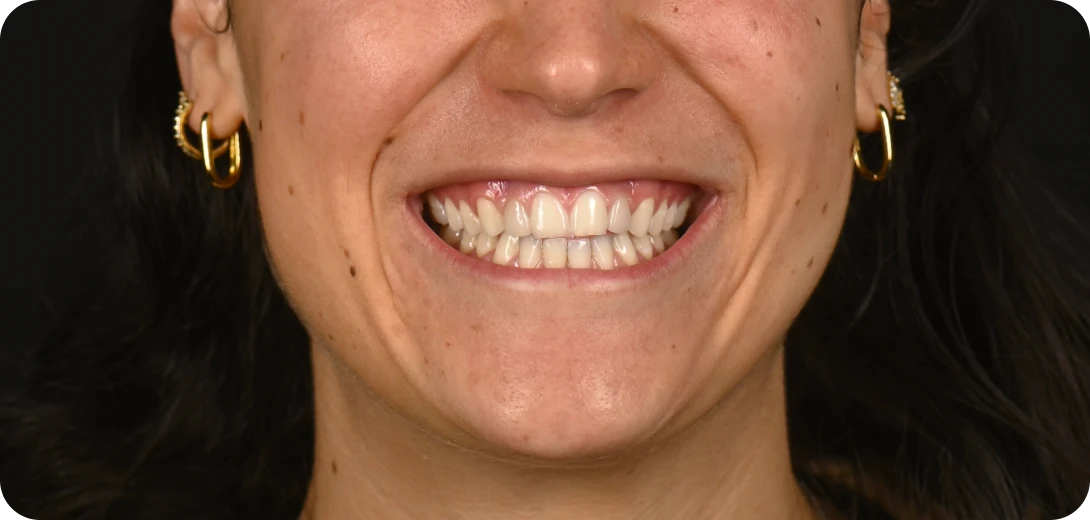 Before