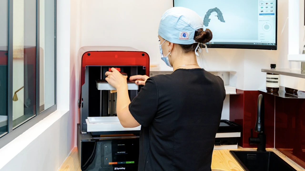 Complet fixe sur implants : impression 3D au laboratoire